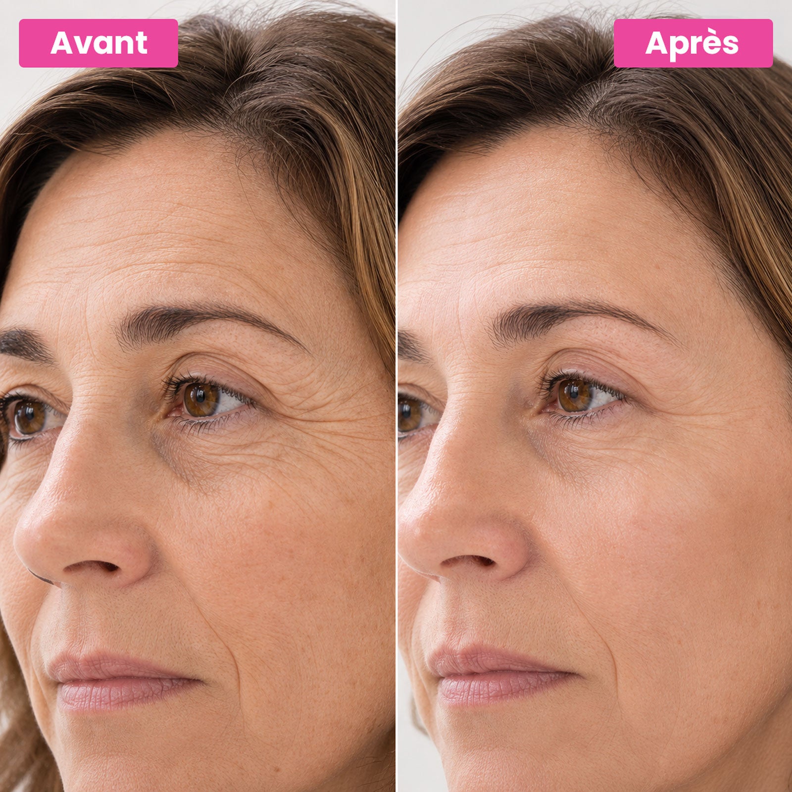 Super C Serolys Serum